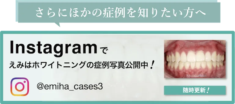 インスタグラムの症例写真アカウントへの外部リンクバナー