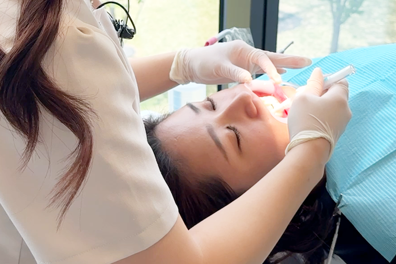 ホワイトニングの薬剤を患者の歯に湿布する歯科衛生士