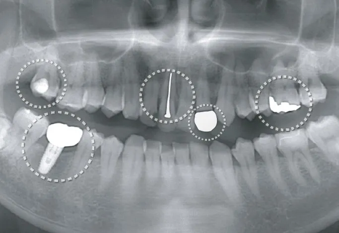 医療用レントゲンシステムのサンプル画像