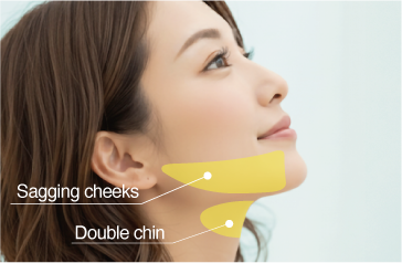 Fat Dissolving Injections