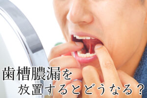 歯槽膿漏
