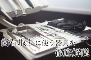 歯石取り