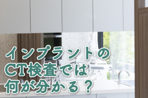 インプラントのCT検査では何が分かる？